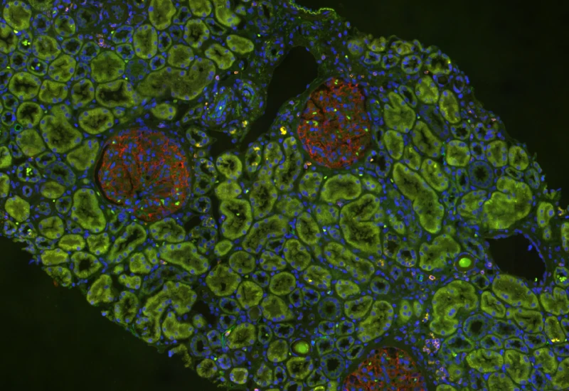 Dynamic Content Image